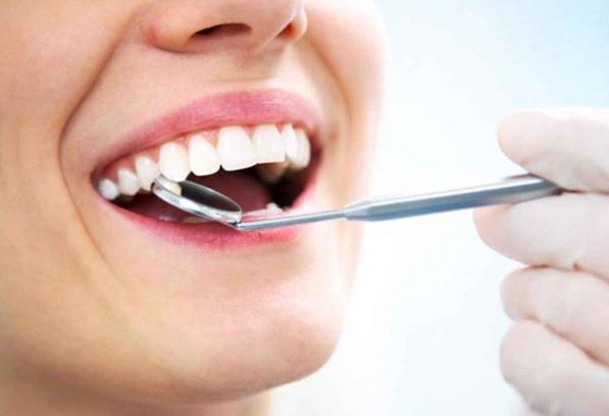 Prevention Treatments – Queensgate Dental Practice